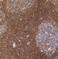 鼠抗人CD44单克隆抗体  TDCCM-0601