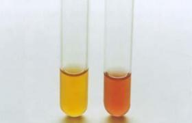 GB4789.4-2016沙门氏菌的检验过程及操作时的注意事项