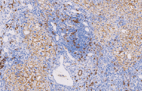 兔抗人CD138单克隆抗体 TDCCR-0781