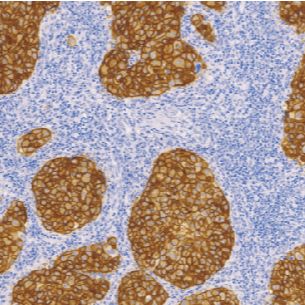 兔抗人C-erbB-2癌基因蛋白单克隆抗体  TDCCR-0843