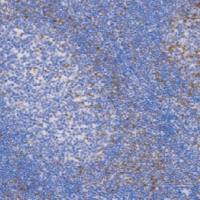 鼠抗人CD152/CTLA-4单克隆抗体 TDCCM-1160