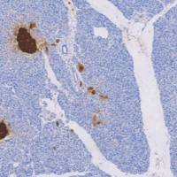 鼠抗人嗜铬素A单克隆抗体  TDCCM-0851