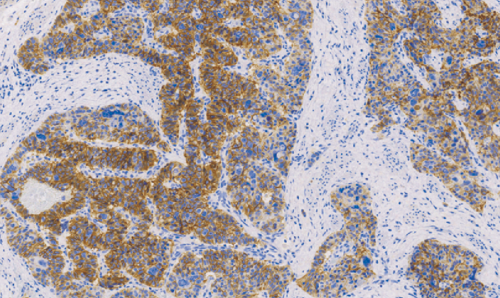 鼠抗人CD56单克隆抗体 TDCCM-0662