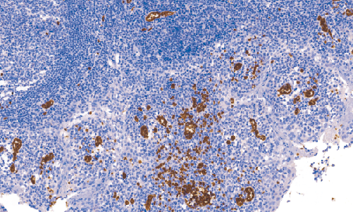 鼠抗人CD235a单克隆抗体   TDCCM-0810