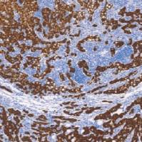 鼠抗人细胞角蛋白8/18单克隆抗体 TDCCM-1011