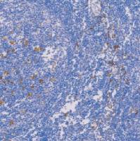 鼠抗人CD163单克隆抗体  TDCCM-0802