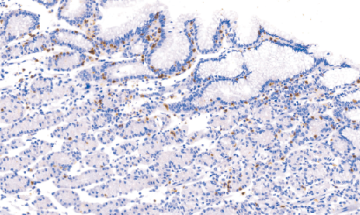 兔抗人CD103单克隆抗体 TDCCR-0750
