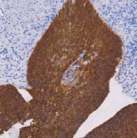 兔抗人细胞角蛋白4单克隆抗体  TDCCR-1260