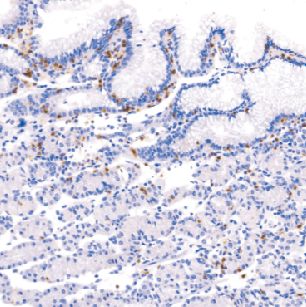 兔抗人CD103单克隆抗体  TDCCR-0750