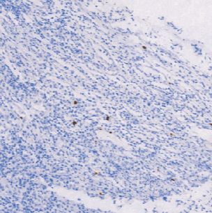 鼠抗人巨细胞病毒单克隆抗体  TDCCM-0890