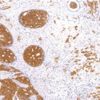 鼠抗人细胞角蛋白（低分子量）单克隆抗体  TDCCM-0920