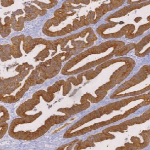 鼠抗人细胞角蛋白(CAM5.2)单克隆抗体  TDCCM-0940