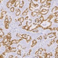 兔抗人CDX2单克隆抗体 TDCCR-0821