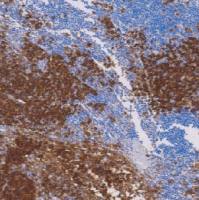 鼠抗人CD63单克隆抗体  TDCCM-0690