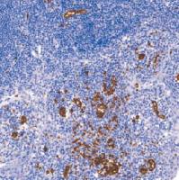 鼠抗人CD235a单克隆抗体 TDCCM-0810