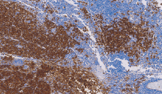 鼠抗人CD63单克隆抗体 TDCCM-0690