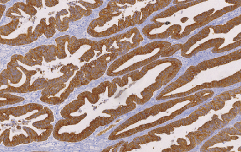 鼠抗人细胞角蛋白(CAM5.2)单克隆抗体 TDCCM-0