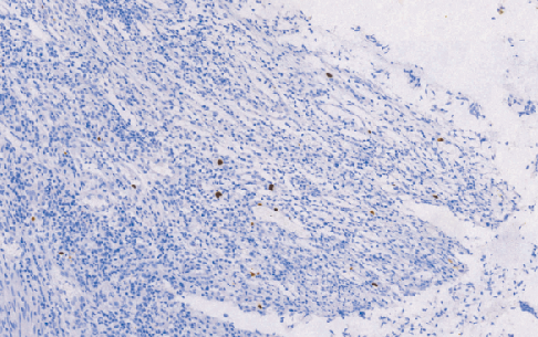 鼠抗人巨细胞病毒单克隆抗体 TDCCM-0890