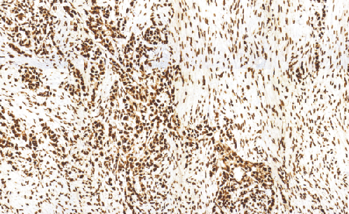 兔抗人CDK4单克隆抗体 TDCCR-0816