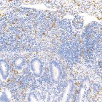 鼠抗人CD163单克隆抗体  TDCCM-0801