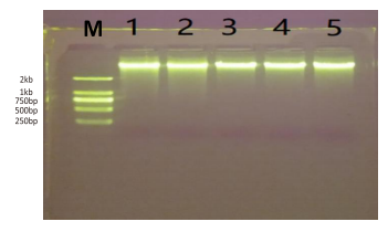 全血基因组DNA提取（磁珠法）的常见问题