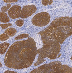 鼠抗人广谱细胞角蛋白单克隆抗体  TDCCM-0960