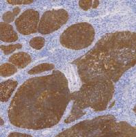 鼠抗人广谱细胞角蛋白单克隆抗体  TDCCM-0960