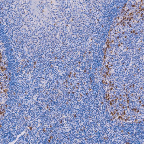 鼠抗人CD57单克隆抗体  TDCCM-0670