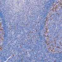 鼠抗人CD57单克隆抗体  TDCCM-0670