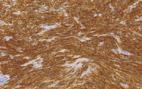 兔抗人CD117单克隆抗体 TDCCR-0760