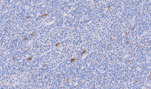 兔抗人CD105单克隆抗体  TDCCR-1191