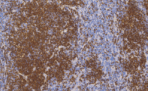 鼠抗人CD79a单克隆抗体 TDCCM-0734