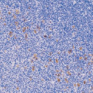 鼠抗人EB病毒单克隆抗体  TDCEM-0010