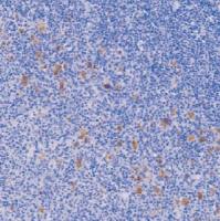 鼠抗人EB病毒单克隆抗体 TDCEM-0010