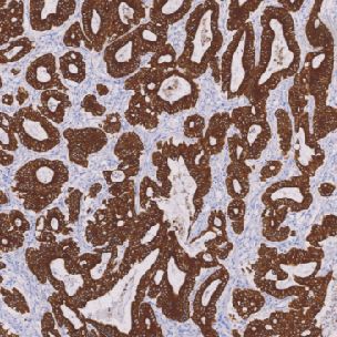 鼠抗人细胞角蛋白18单克隆抗体  TDCCM-1090