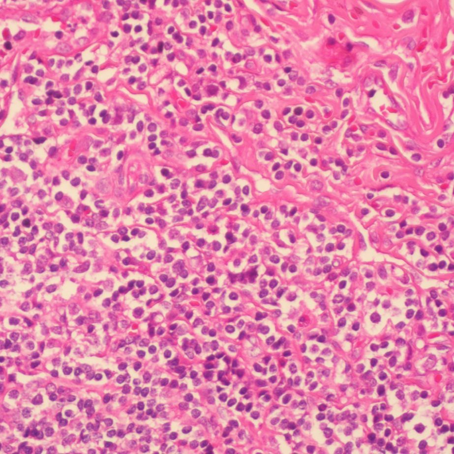 中杉金桥 BSBA-4021A 苏木素染色液