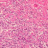 中杉金桥  BSBA-4021A  苏木素染色液