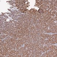 中杉金桥  ISH-7001  EBER检测试剂盒（原位杂交法）