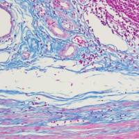 中杉金桥 BSBA-4079A  Masson三色染色液5×20ml