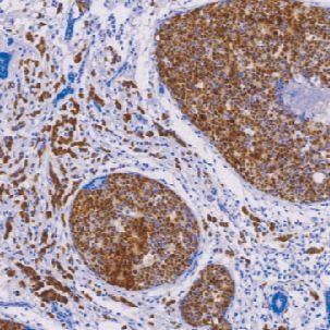 兔抗人细胞周期蛋白 D1单克隆抗体  TDCCR-1142