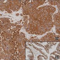 中杉金桥  PV-9002  小鼠二步法检测试剂盒（小鼠增强聚合物法检测系统）55ml