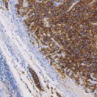 鼠抗人D2-40 单克隆抗体 TDCDM-0010