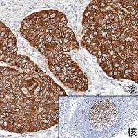 中杉金桥  PV-6000  通用型试剂盒（小鼠/兔聚合物法检测系统）110ml