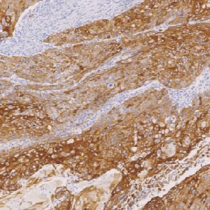 兔抗人细胞角蛋白17单克隆抗体  TDCCR-1081