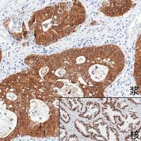 中杉金桥  PV-6002  小鼠二步法试剂盒（小鼠聚合物法检测系统）110ml