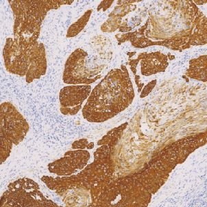 鼠抗人细胞角蛋白14单克隆抗体  TDCCM-1052