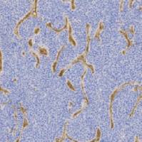 鼠抗人 IV 型胶原单克隆抗体  TDCCM-1131