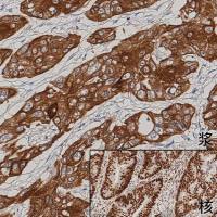 中杉金桥  PV-9003  山羊二步法检测试剂盒（山羊增强聚合物法检测系统）18ml