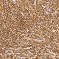 鼠抗人DOG-1单克隆抗体  TDCDM-0033