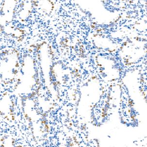 兔抗人细胞周期蛋白 E1单克隆抗体  TDCCR-1230